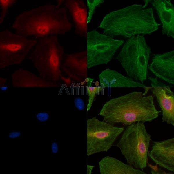Phospho-Nrf2 (Ser40) Antibody - DF7519 staining A549 cells(4h of LPS treatment) by IF/ICC.