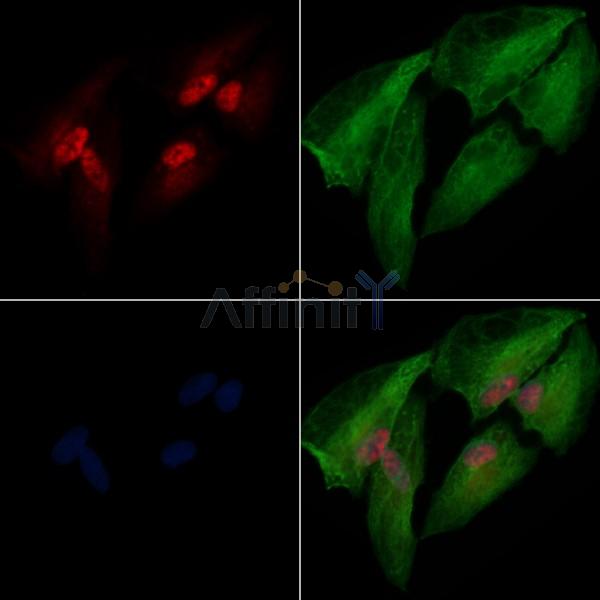 HMGB3 Antibody - DF7825 staining A549 cells by IF/ICC.