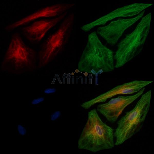 ENTPD5 Antibody - DF7901 staining A549 cells by IF/ICC.