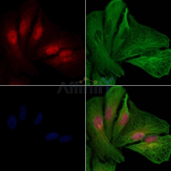 UBE2M Antibody - DF8243 staining A549 cells by IF/ICC.