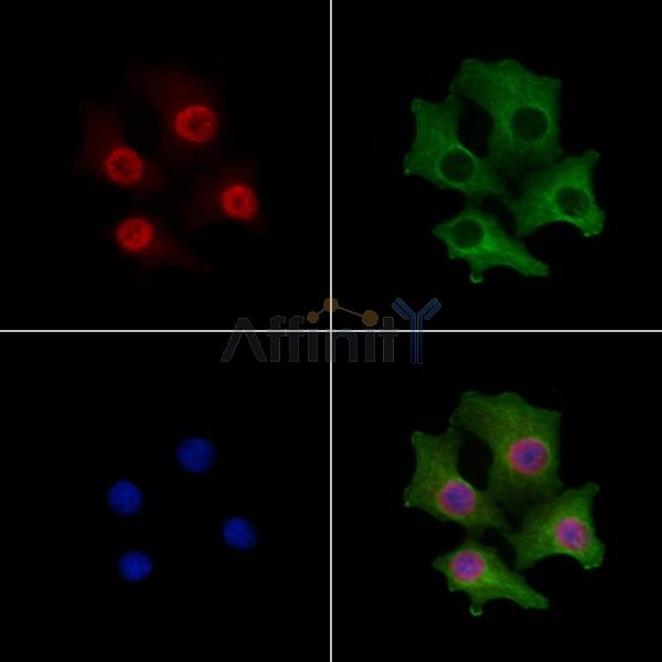 FOG2 Antibody - DF8852 staining Hela cells by IF/ICC.
