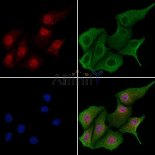 CIDEA Antibody - DF9053 staining Hela cells by IF/ICC.