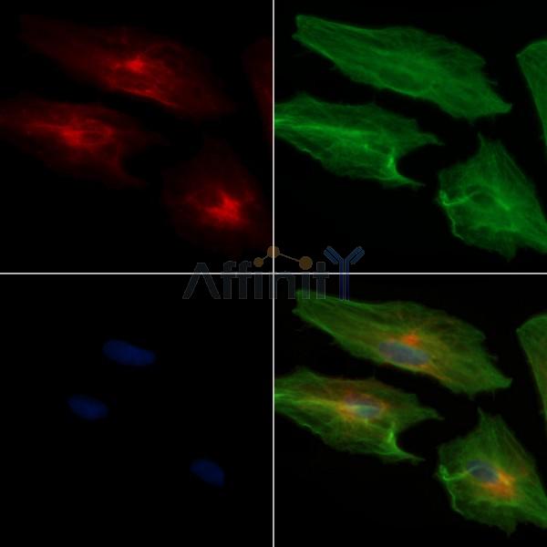 ADAM33 Antibody - DF9166 staining A549 cells by IF/ICC.