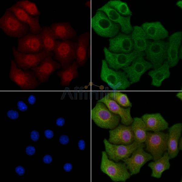 APBA1 Antibody - DF9202 staining Hela cells by IF/ICC.
