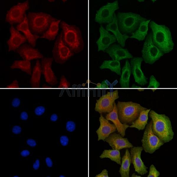 AAMP Antibody - DF9207 staining Hela cells by IF/ICC.