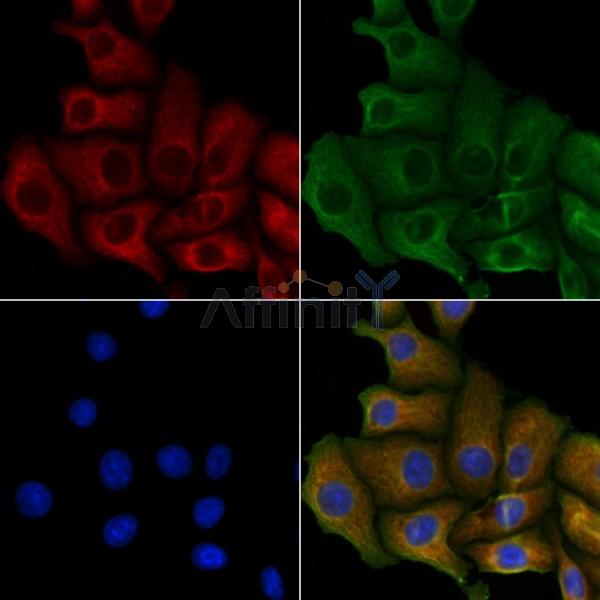 HACE1 Antibody - DF9477 staining Hela cells by IF/ICC.