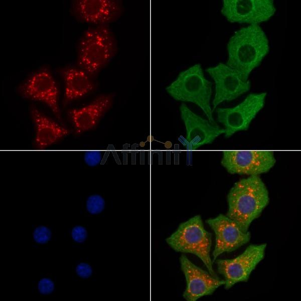 NDUFS6 Antibody - DF9671 staining Hela cells by IF/ICC.