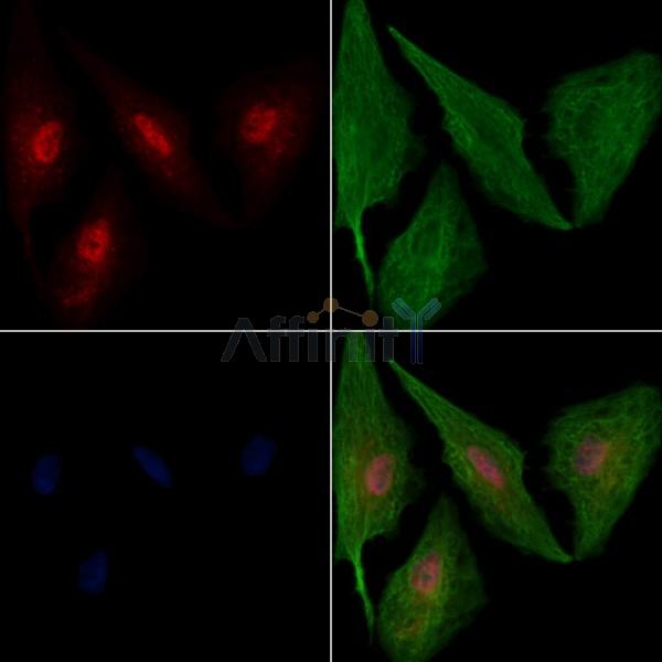 NAV2 Antibody - DF9695 staining A549 cells by IF/ICC.
