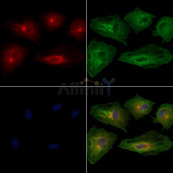 RAB17 Antibody - DF9815 staining A549 cells by IF/ICC.