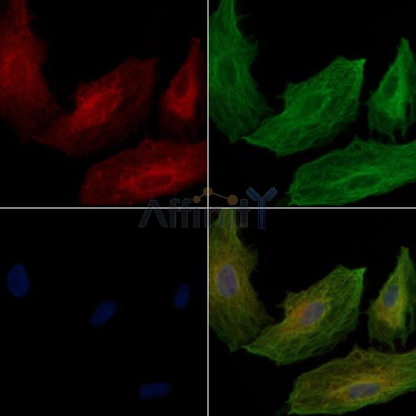 RAB1A Antibody - DF9817 staining A549 cells by IF/ICC.