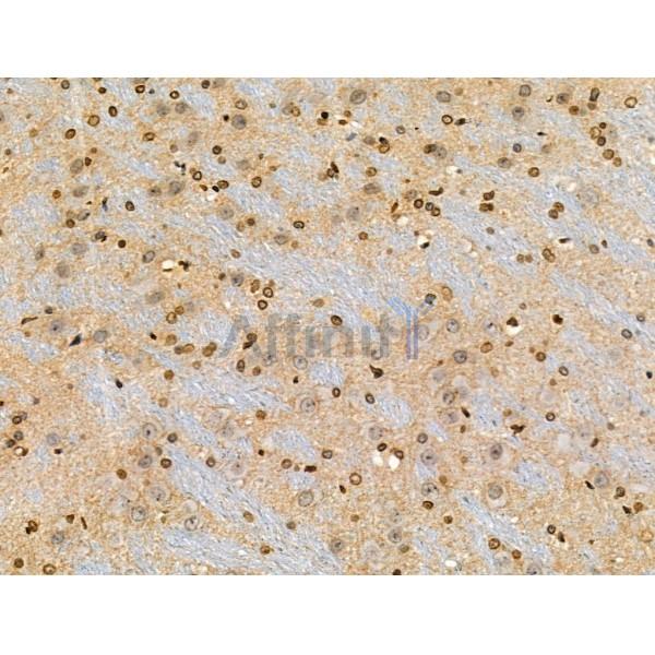 Phospho-MKK4 (Ser257/Thr261) Antibody - AF3862 at 1/100 staining Rat brain tissue by IHC-P.