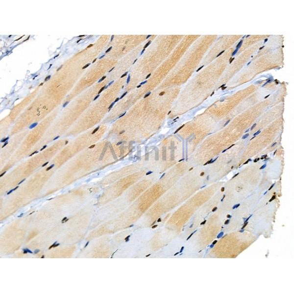 Phospho-MKK4 (Ser257/Thr261) Antibody - AF3862 at 1/100 staining Rat skin tissue by IHC-P.