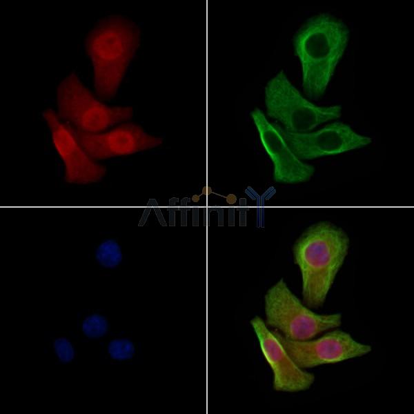 Phospho-p53 (Ser33) Antibody - AF3873 staining Hela cells(heat shock treatment) by IF/ICC.