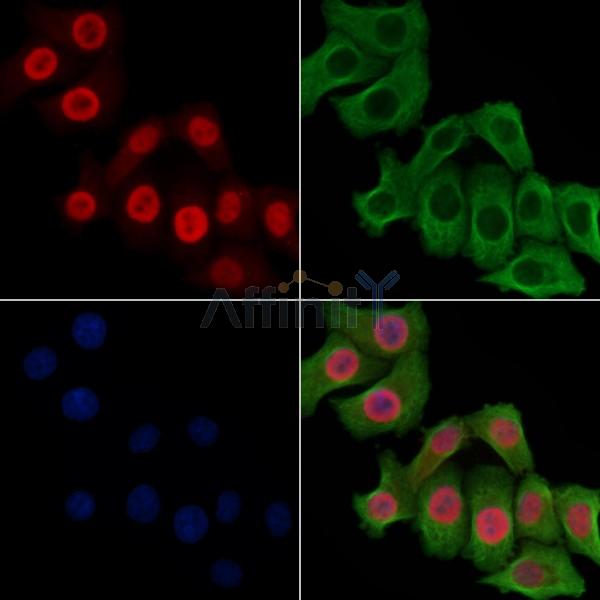 Phospho-MCM2 (Ser108) Antibody - AF3877 staining Hela cells(heat shock treatment) by IF/ICC.