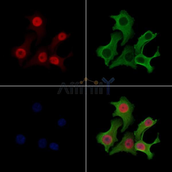 Phospho-MCM2 (Ser41) Antibody - AF3880 staining Hela cells(heat shock treatment) by IF/ICC.