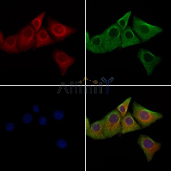 Phospho-LRRK2 (Ser910) Antibody - AF3887 staining Hela cells(heat shock treatment) by IF/ICC.