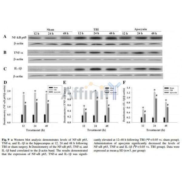 IL1 beta Antibody - WB analysis demonstrates levels of IL1-beta in rat brain.