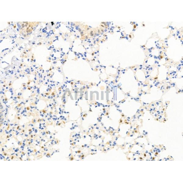 S100A4 Antibody - AF5320 at 1/100 staining Mouse lung tissue by IHC-P.