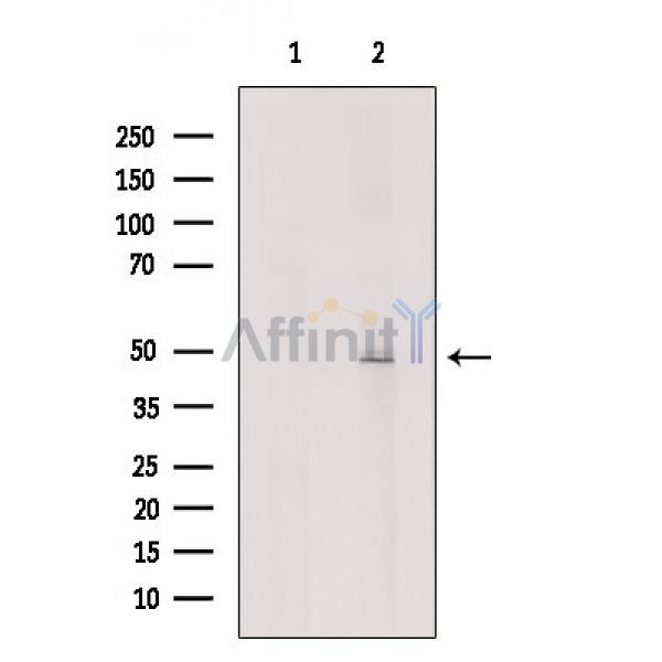 Foxp3 Antibody - Western blot analysis of FOXP3 expression in MCF-7 cells.