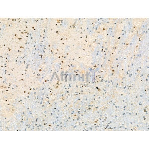 Phospho-PDX1 (Ser66) Antibody - AF8301 at 1/100 staining Rat brain tissue by IHC-P.