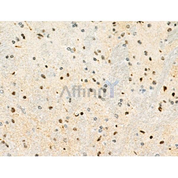 Phospho-PDX1 (Ser66) Antibody - AF8301 at 1/100 staining Mouse brain tissue by IHC-P.