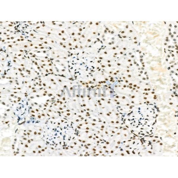 Phospho-PDX1 (Ser66) Antibody - AF8301 at 1/100 staining Rat kidney tissue by IHC-P.