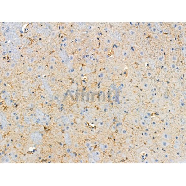 Phospho-ROCK2 (Tyr722) Antibody - AF8402 at 1/100 staining Rat brain tissue by IHC-P.