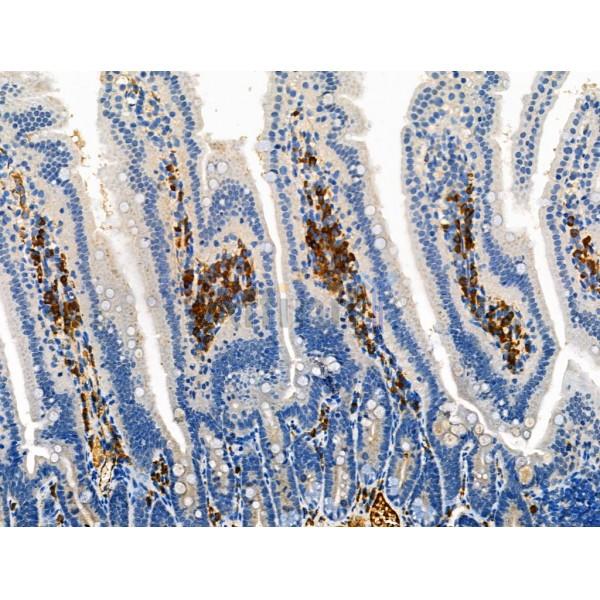 Phospho-ROCK2 (Tyr722) Antibody - AF8402 at 1/100 staining Mouse colorectal tissue by IHC-P.