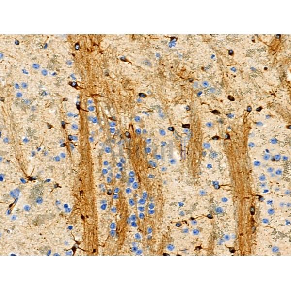 Phospho-Bcl-2 (Thr74) Antibody - AF8465 at 1/100 staining Mouse brain tissue by IHC-P.
