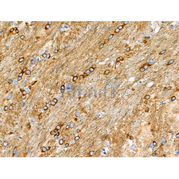 Phospho-Bcl-2 (Thr74) Antibody - AF8465 at 1/100 staining Rat brain tissue by IHC-P.