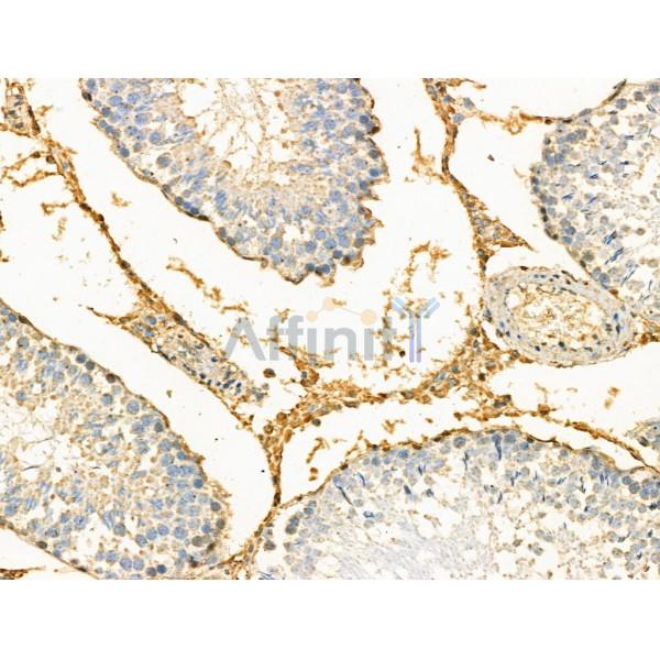 Phospho-CKB (Ser199) Antibody - AF8602 at 1/100 staining Rat testis tissue by IHC-P.