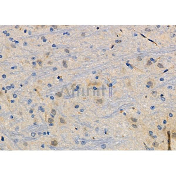 ZNF462 Antibody - DF10018 at 1/100 staining Rat brain tissue by IHC-P.