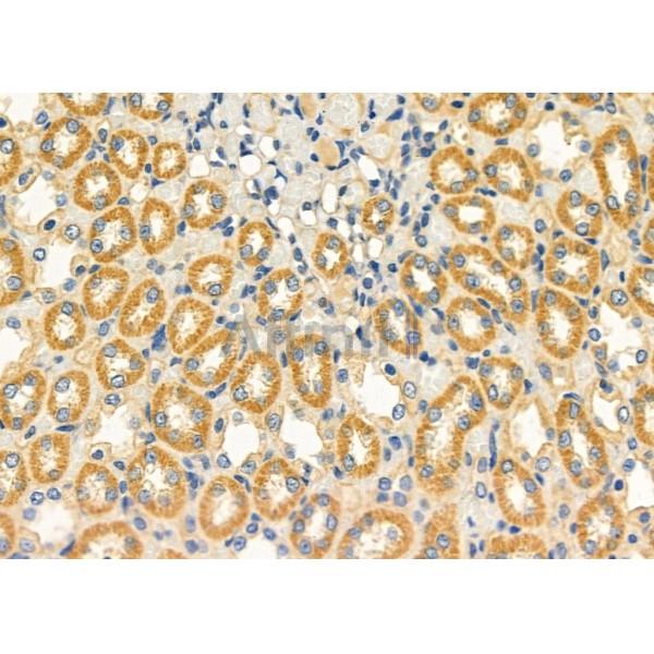 ASPM Antibody - DF10064 at 1/100 staining Rat kidney tissue by IHC-P.