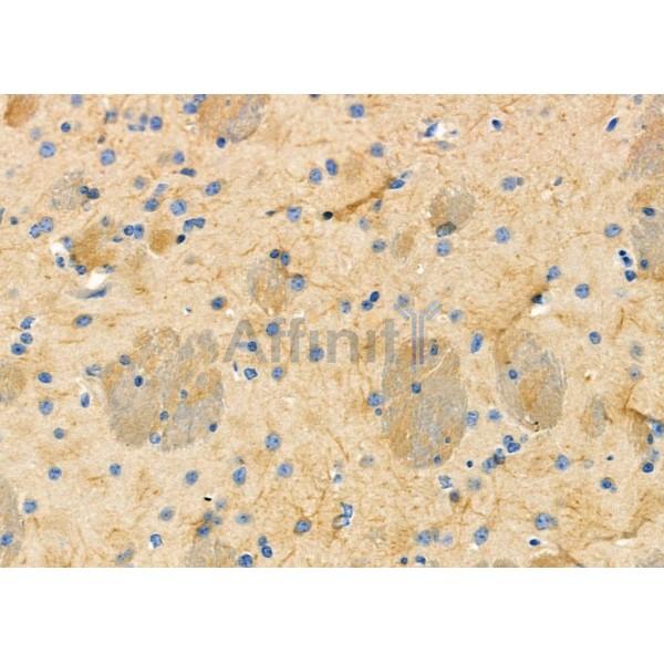 IGFL2 Antibody - DF10110 at 1/100 staining Mouse brain tissue by IHC-P.