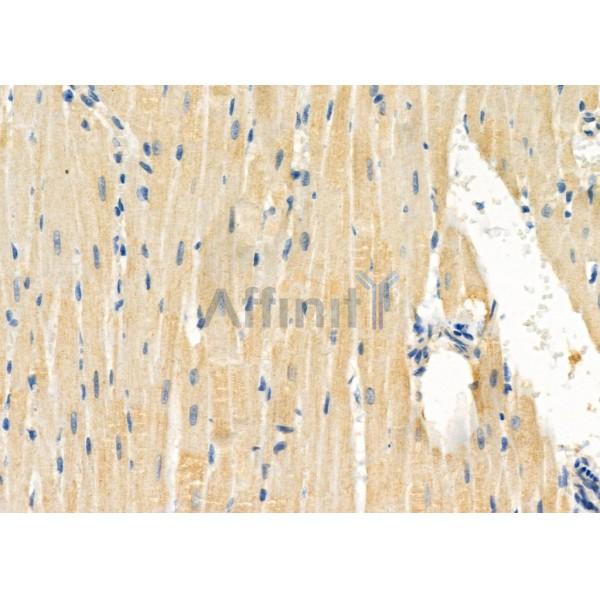 IGFL2 Antibody - DF10110 at 1/100 staining Rat heart tissue by IHC-P.