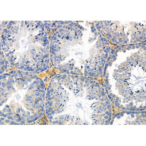 KRT81/86 Antibody - DF10117 at 1/100 staining Mouse testis tissue by IHC-P.