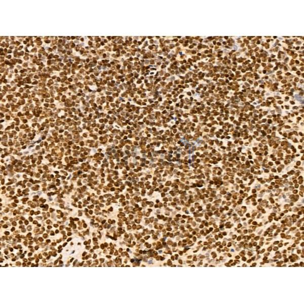 NDOR1 Antibody - DF13177 at 1/100 staining Mouse spleen tissue by IHC-P.