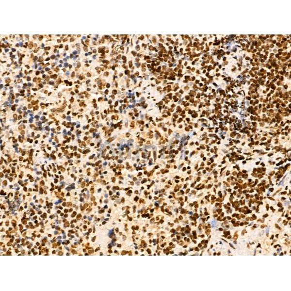 NDOR1 Antibody - DF13177 at 1/100 staining Rat spleen tissue by IHC-P.