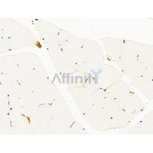 Hhip Antibody - DF13634 at 1/100 staining Mouse muscle tissue by IHC-P.