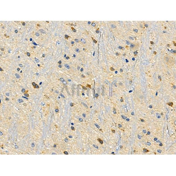 HAPLN1 Antibody - DF2923 at 1/100 staining Rat brain tissue by IHC-P.