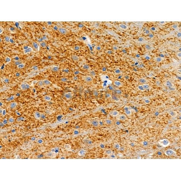 MOT13 Antibody - DF4180 at 1/100 staining Rat brain tissue by IHC-P.