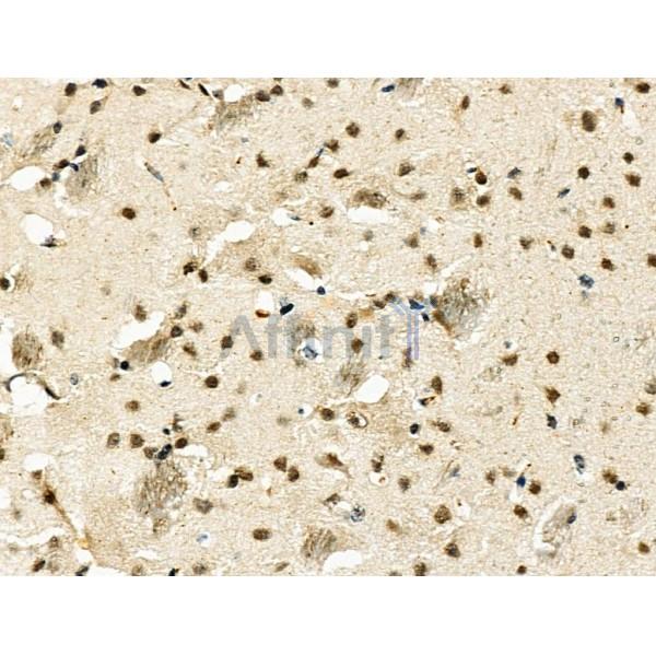 MDFI Antibody - DF4193 at 1/100 staining Mouse brain tissue by IHC-P.