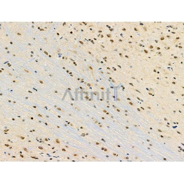 MDFI Antibody - DF4193 at 1/100 staining Rat brain tissue by IHC-P.