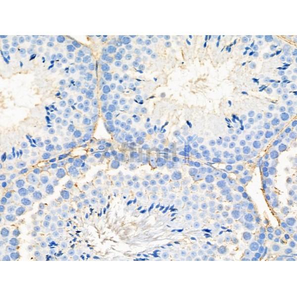 NCAN Antibody - DF4236 at 1/100 staining Mouse testis tissue by IHC-P.