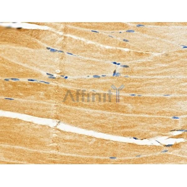 NCAN Antibody - DF4236 at 1/100 staining Mouse muscle tissue by IHC-P.
