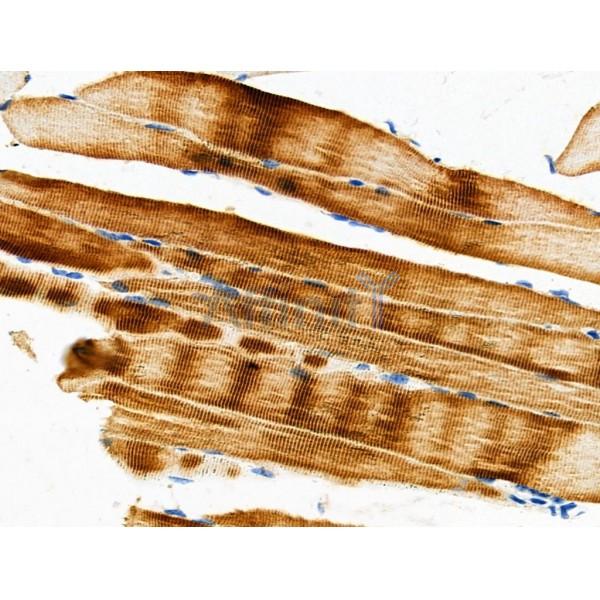PDK2 Antibody - DF4366 at 1/100 staining Mouse muscle tissue by IHC-P.