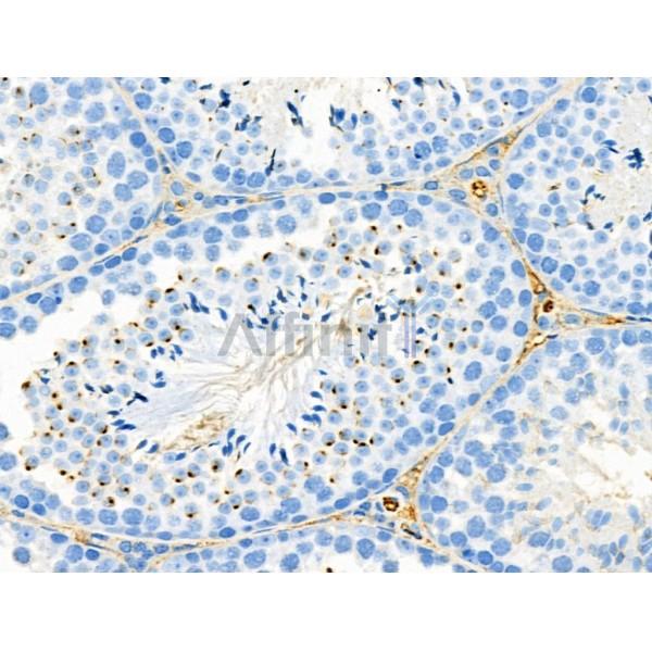 RANBP17 Antibody - DF4379 at 1/100 staining Mouse testis tissue by IHC-P.