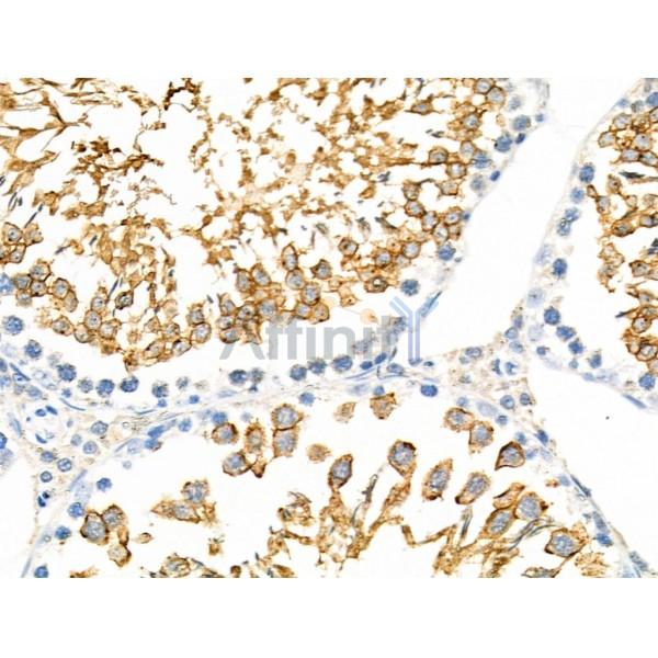 RANBP17 Antibody - DF4379 at 1/100 staining Rat testis tissue by IHC-P.