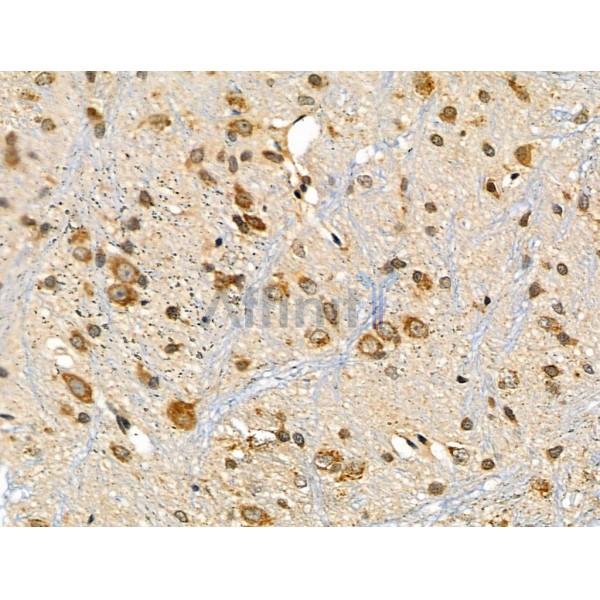 ARHGEF7 Antibody - DF4436 at 1/100 staining Rat brain tissue by IHC-P.