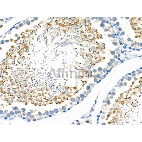 STK32C Antibody - DF4464 at 1/100 staining Rat testis tissue by IHC-P.